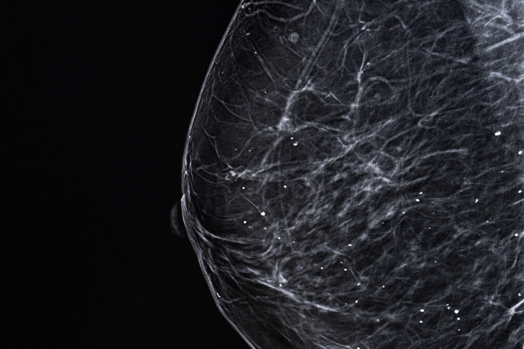 examen-sein-cancer-bordeaux3