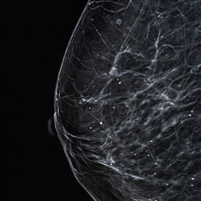 examen-sein-cancer-bordeaux3
